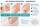 deramed Gel-Zehenschutzkappe (Protective Gel Toe Cap)